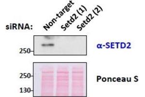 SETD2 Antibody (0. (SETD2 Antikörper  (Internal Region))