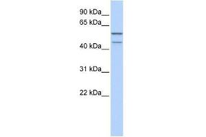 Western Blot showing ZNF474 antibody used at a concentration of 1-2 ug/ml to detect its target protein. (ZNF474 Antikörper  (N-Term))