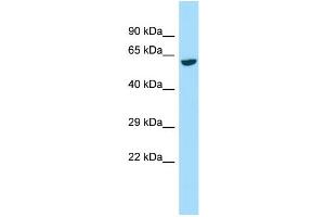 Host:  Rabbit  Target Name:  Galnt2  Sample Type:  Rat Kidney lysates  Antibody Dilution:  1. (GALNT2 Antikörper  (C-Term))