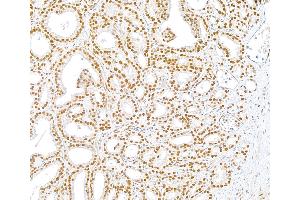 Immunohistochemistry (IHC) image for anti-U2 Small Nuclear RNA Auxiliary Factor 1 (U2AF1) (AA 140-190) antibody (ABIN7453889)