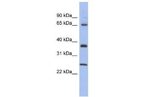 WB Suggested Anti-HORMAD2 Antibody Titration: 0. (HORMAD2 Antikörper  (Middle Region))