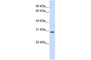 WB Suggested Anti-SLC25A20 Antibody Titration:  0. (SLC25A20 Antikörper  (C-Term))