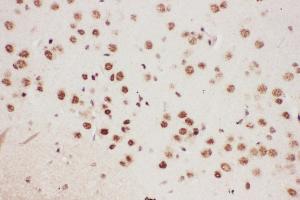 Anti-ALOX5 Picoband antibody,  IHC(P): Mouse Brain Tissue (ALOX5 Antikörper  (AA 120-483))
