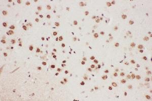 Anti-ALOX5 Picoband antibody,  IHC(P): Mouse Brain Tissue