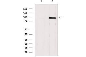 Western blot analysis of extracts from mouse brain, using GSN Antibody. (Gelsolin Antikörper  (C-Term))