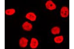 Immunofluorescent analysis of BAF170 staining in Raji cells. (SMARCC2 Antikörper  (Center))