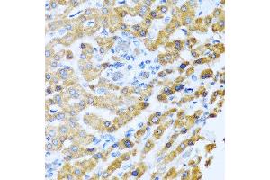 Immunohistochemistry of paraffin-embedded human liver using PROK2 antibody at dilution of 1:100 (40x lens).