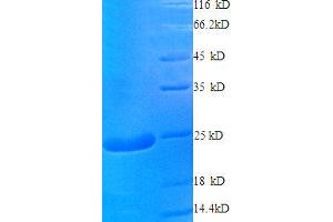 Cysteine and Glycine-Rich Protein 2 (CSRP2) (AA 2-193), (full length) protein (His tag) (CSRP2 Protein (AA 2-193, full length) (His tag))