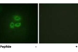 Immunofluorescence analysis of A-549 cells, using PRKD1 polyclonal antibody . (PKC mu Antikörper  (Ser205))