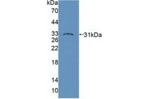 Detection of Recombinant PTPN22, Human using Polyclonal Antibody to Protein Tyrosine Phosphatase, Non Receptor Type 22 (PTPN22) (PTPN22 Antikörper  (AA 1-233))