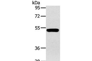 Western Blot analysis of Human fetal muscle tissue using GJA9 Polyclonal Antibody at dilution of 1:400 (GJA9 Antikörper)