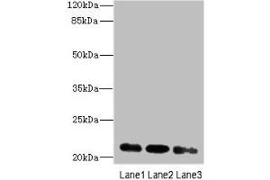 Western blot All lanes: MRPL11 antibody at 16 μg/mL Lane 1: HepG2 whole cell lysate Lane 2: Hela whole cell lysate Lane 3: A549 whole cell lysate Secondary Goat polyclonal to rabbit IgG at 1/10000 dilution Predicted band size: 21, 19, 20 kDa Observed band size: 21 kDa (MRPL11 Antikörper  (AA 1-191))