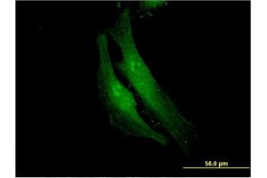 Immunofluorescence of monoclonal antibody to FANCF on HeLa cell. (FANCF Antikörper  (AA 1-91))