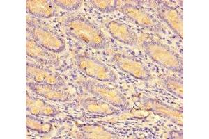 Immunohistochemistry of paraffin-embedded human small intestine tissue using ABIN7146019 at dilution of 1:100 (CCL8 Antikörper  (AA 24-99))