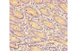 Immunohistochemistry of paraffin-embedded human small intestine tissue using ABIN7146019 at dilution of 1:100
