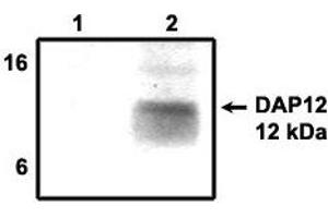 Immunoprecipitation using DAP12  antibody on MHC class I (1) and  NKp44 (2) positive cells. (TYROBP Antikörper  (Cytoplasmic Domain))
