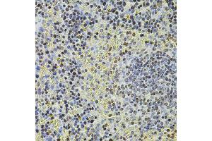 Immunohistochemistry of paraffin-embedded mouse spleen using POT1 antibody (ABIN5970699) at dilution of 1/100 (40x lens). (POT1 Antikörper)