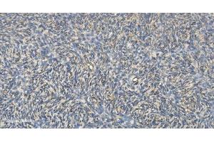 IHC analysis of FLCN using anti-FLCN antibody (ABIN7602491).