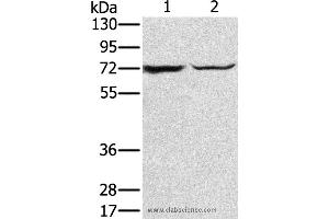 Western blot analysis of Mouse liver tissue and hepg2 cell, using SLC25A13 Polyclonal Antibody at dilution of 1:450 (slc25a13 Antikörper)