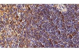 Immunohistochemistry (IHC) image for anti-CD4 (CD4) (AA 26-396) antibody (ABIN7437032)