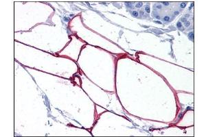 Human Adipocytes: Formalin-Fixed, Paraffin-Embedded (FFPE) (PLIN4 Antikörper  (Internal Region))