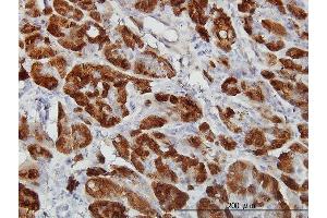Immunostaining (ISt) image for anti-Cystathionase (Cystathionine gamma-Lyase) (CTH) (AA 1-405) antibody (ABIN560523)