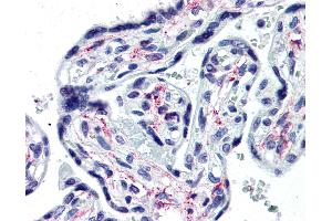 Anti-IL1R1 antibody IHC of human placenta. (IL1R1 Antikörper  (Extracellular Domain))