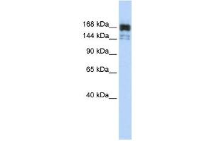 XRN1 antibody used at 1 ug/ml to detect target protein.