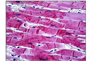 Immunohistochemistry (IHC) image for anti-Heat Shock 22kDa Protein 8 (HSPB8) antibody (ABIN781911) (HSPB8 Antikörper)