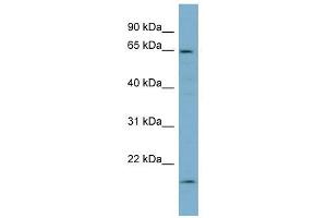 Plastin 3 antibody used at 1 ug/ml to detect target protein. (Plastin 3 Antikörper)