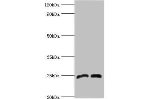 Western blot All lanes: Dickkopf-related protein 4 antibody at 8 μg/mL Lane 1: Jurkat whole cell lysate Lane 2: K562 whole cell lysate Secondary Goat polyclonal to rabbit IgG at 1/10000 dilution Predicted band size: 25 kDa Observed band size: 25 kDa (DKK4 Antikörper  (AA 19-224))