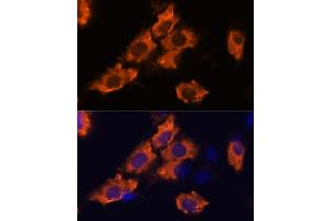 Immunofluorescence analysis of C6 cells using SEMA antibody (ABIN7270199) at dilution of 1:100. (Sema4a Antikörper  (AA 320-580))