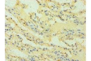 Immunohistochemistry (IHC) image for anti-HLA Class I Histocompatibility Antigen, alpha Chain G (HLAG) (AA 20-230) antibody (ABIN7155546)