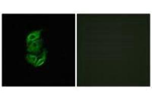 Immunofluorescence analysis of A549 cells, using STA13 antibody. (STARD13 Antikörper  (N-Term))