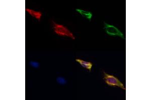 ABIN6262190 and ABIN6269019 staining HepG2 by IF/ICC. (HDAC7 Antikörper  (C-Term))