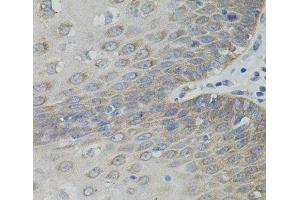 Immunohistochemistry of paraffin-embedded Human esophagus using SLC30A1 Polyclonal Antibody (SLC30A1 Antikörper)