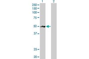 Western Blotting (WB) image for anti-Nuclear Receptor Subfamily 2, Group E, Member 3 (NR2E3) (AA 1-410) antibody (ABIN523376)