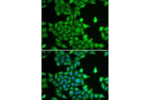 Immunofluorescence analysis of MCF-7 cell using PSMA6 antibody. (PSMA6 Antikörper  (AA 1-246))