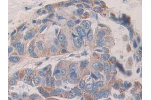 Immunohistochemistry (IHC) image for anti-Killer Cell Immunoglobulin-Like Receptor, Two Domains, Long Cytoplasmic Tail, 2 (KIR2DL2) (AA 22-348) antibody (ABIN1859537)