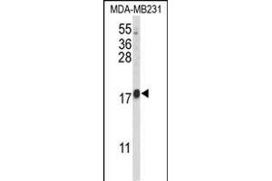 Western blot analysis of HRIHF Antibody (C-term) (ABIN653093 and ABIN2842686) in MDA-M cell line lysates (35 μg/lane). (CBY1/PGEA1 Antikörper  (C-Term))