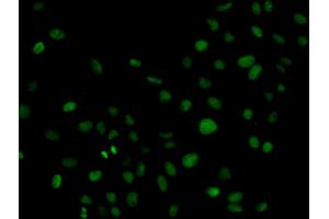 Immunofluorescence analysis of HeLa cells using PLCG2 antibody (ABIN5971208). (Phospholipase C gamma 2 Antikörper)