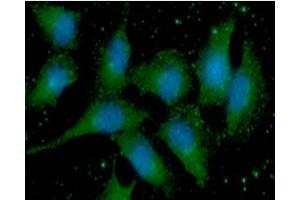 ICC/IF analysis of S100A11 in A549 cells line, stained with DAPI (Blue) for nucleus staining and monoclonal anti-human S100A11 antibody (1:100) with goat anti-mouse IgG-Alexa fluor 488 conjugate (Green). (S100A11 Antikörper  (AA 1-105))
