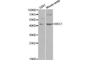 Western blot analysis of extracts of various cell lines, using DKC1 antibody (ABIN5970956) at 1/1000 dilution. (DKC1 Antikörper)