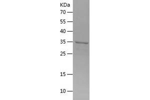 Western Blotting (WB) image for anthrax Toxin Receptor 1 (ANTXR1) (AA 95-204) protein (His-IF2DI Tag) (ABIN7283423) (ANTXR1 Protein (AA 95-204) (His-IF2DI Tag))