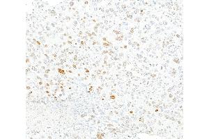 Immunohistochemistry (IHC) image for anti-gamma Histone Variant H2AX (GAMMA-H2AX) (Ser140) antibody (ABIN7454026) (Rekombinanter gamma H2AX Antikörper  (Ser140))