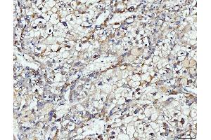 IHC analysis of DUSP6 using anti-DUSP6 antibody (ABIN7599332).