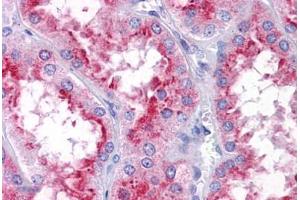 Human Kidney: Formalin-Fixed, Paraffin-Embedded (FFPE) (PICALM Antikörper  (N-Term))