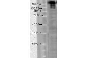 Image no. 1 for anti-Sodium Channel, Voltage-Gated, Type IX, alpha Subunit (SCN9A) (AA 1751-1946) antibody (ABIN466986) (SCN9A Antikörper  (AA 1751-1946))