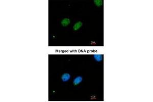 ICC/IF Image Immunofluorescence analysis of paraformaldehyde-fixed HeLa, using XRCC4, antibody at 1:200 dilution. (XRCC4 Antikörper  (C-Term))