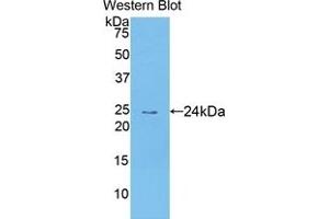 Detection of Recombinant TECK, Human using Polyclonal Antibody to Thymus Expressed Chemokine (TECK) (CCL25 Antikörper  (AA 24-150))